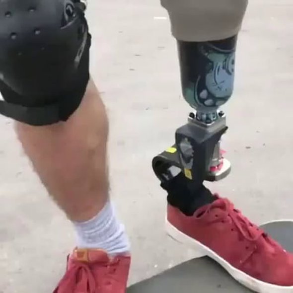 Skating with a prosthesis.