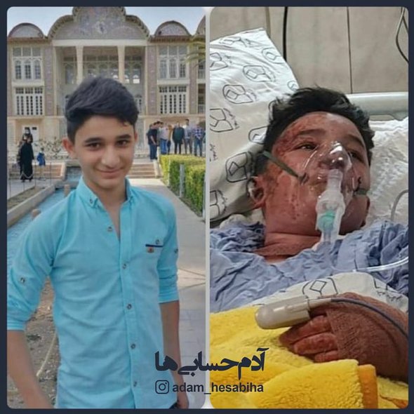 This week, 14 yo Ali, saved an old lady and her daughter from fire. He himself sadly passed away after two days in hospital.